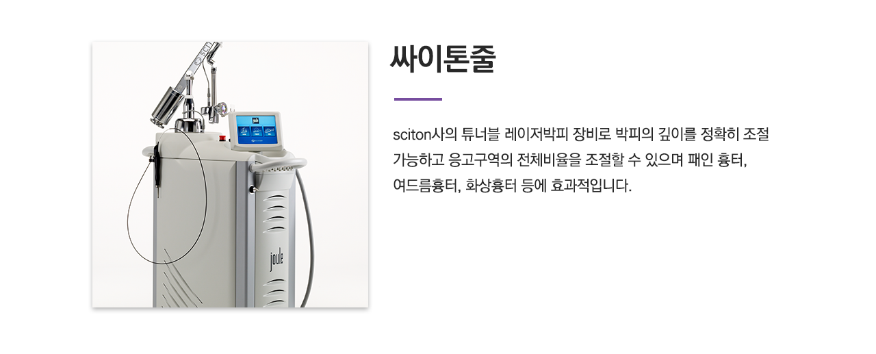 싸이톤줄(sciton사의 튜너블 레이저박피 장비로 박피의 깊이를 정확히 조절 가능하고 응고구역의 전체비율을 조절할 수 있으며 패인 흉터, 여드름흉터, 화상흉터 등에 효과적입니다.)